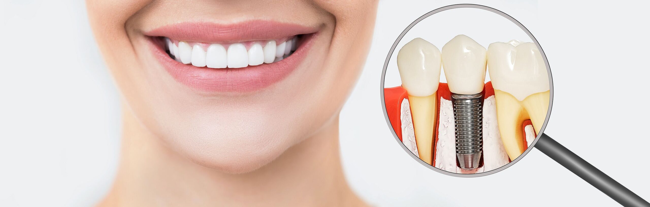 bigstock-Perfect-Female-Smile-Teeth-Af-404218004